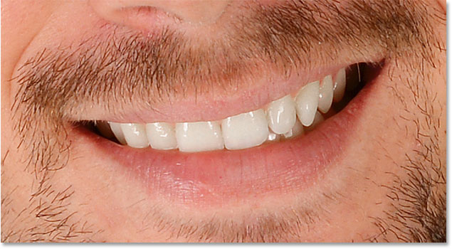 نحوه سفید کردن دندان در فتوشاپ - کاهش زردی دندان با Saturation در فتوشاپ