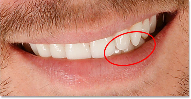 تنظیم روشنایی دندان های خاص در فتوشاپ