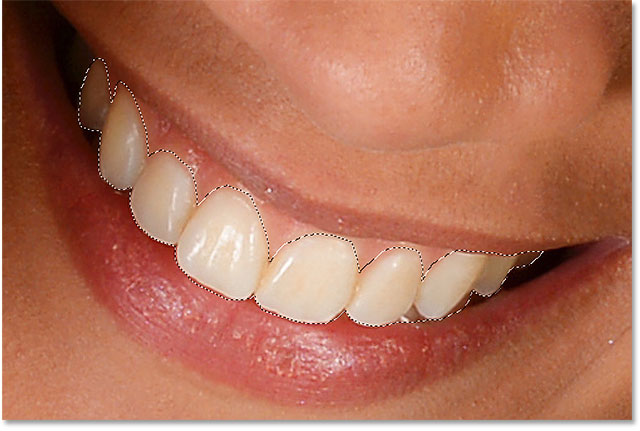 انتخاب دندان ها در فتوشاپ