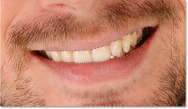 نحوه سفید کردن دندان در فتوشاپ